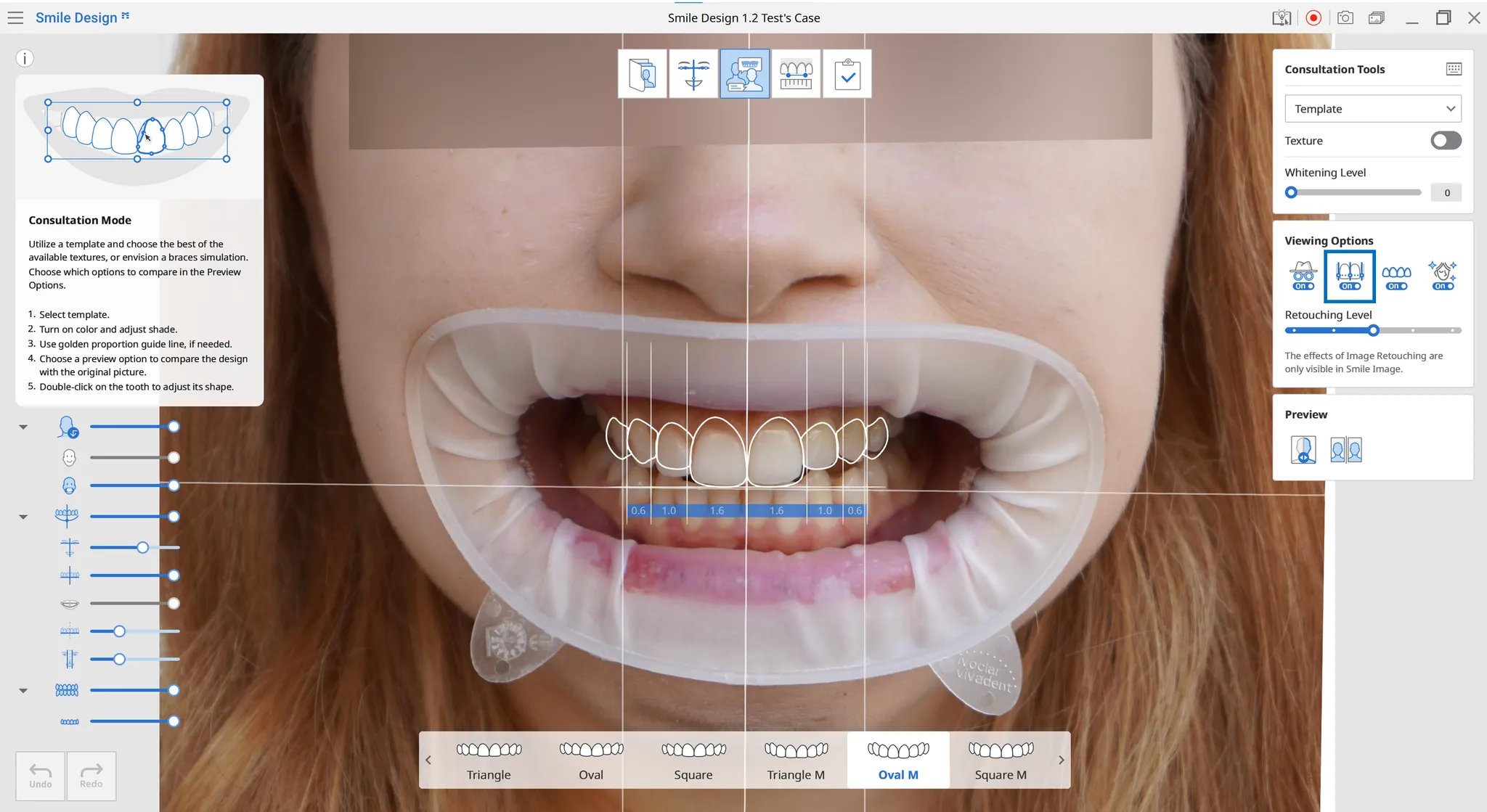 golden proportion.webp
