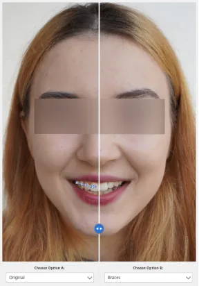 before and after 1.webp