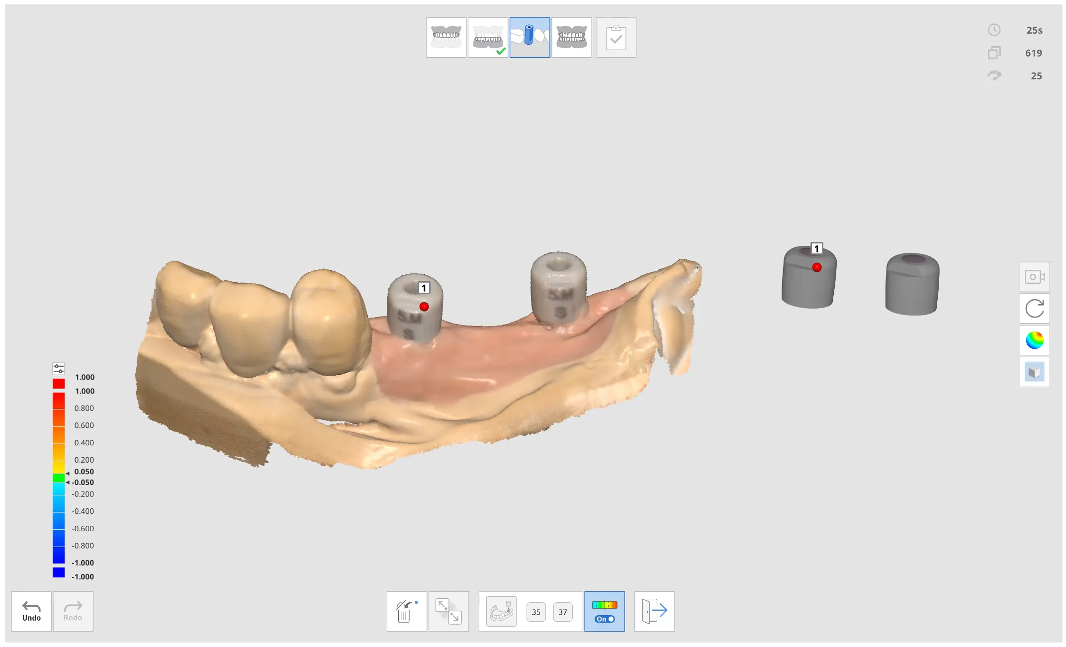 scan body alignment.webp