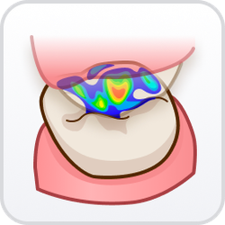Occlusion Analyzer.png