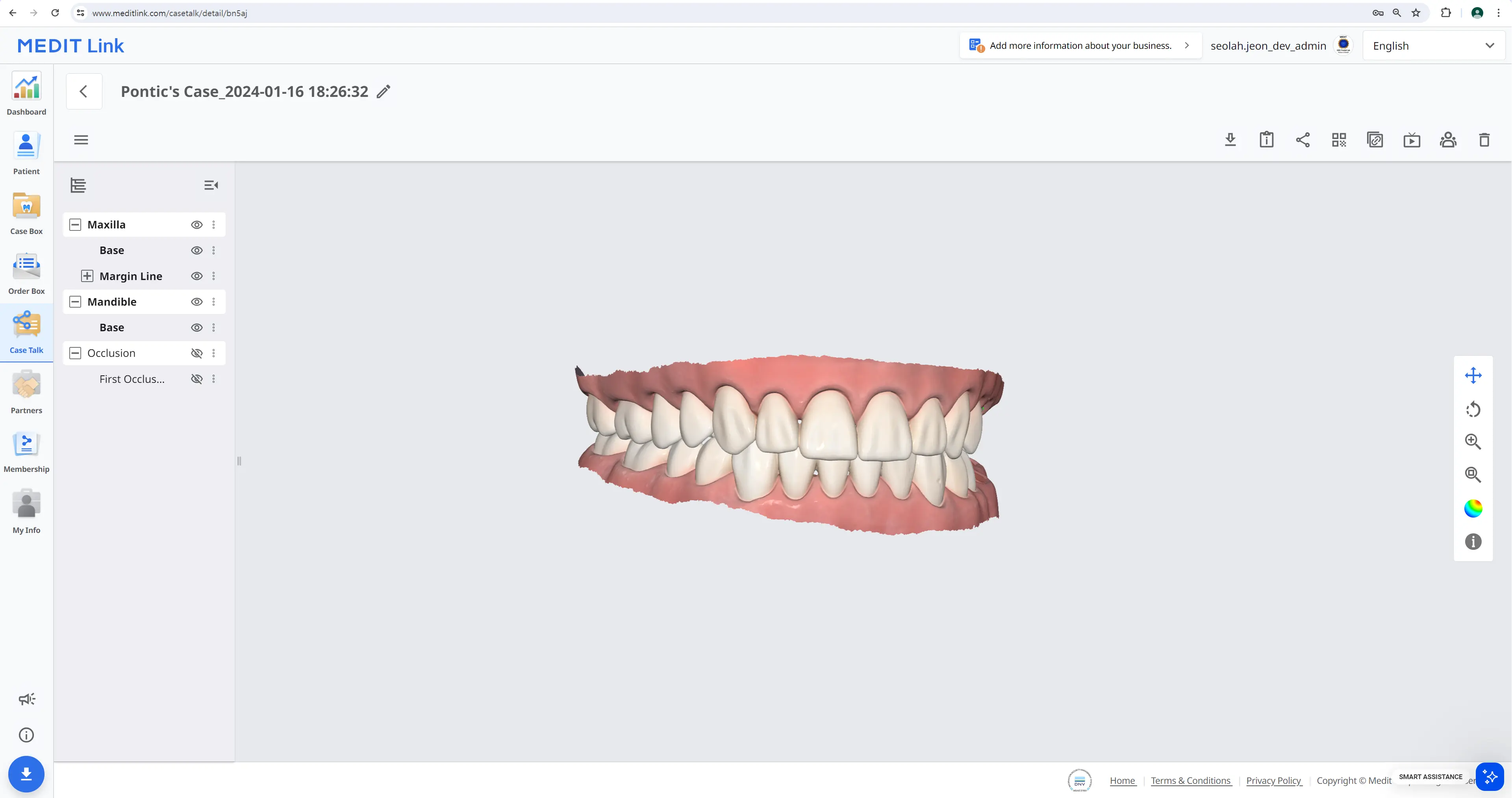 Case Talk details.webp