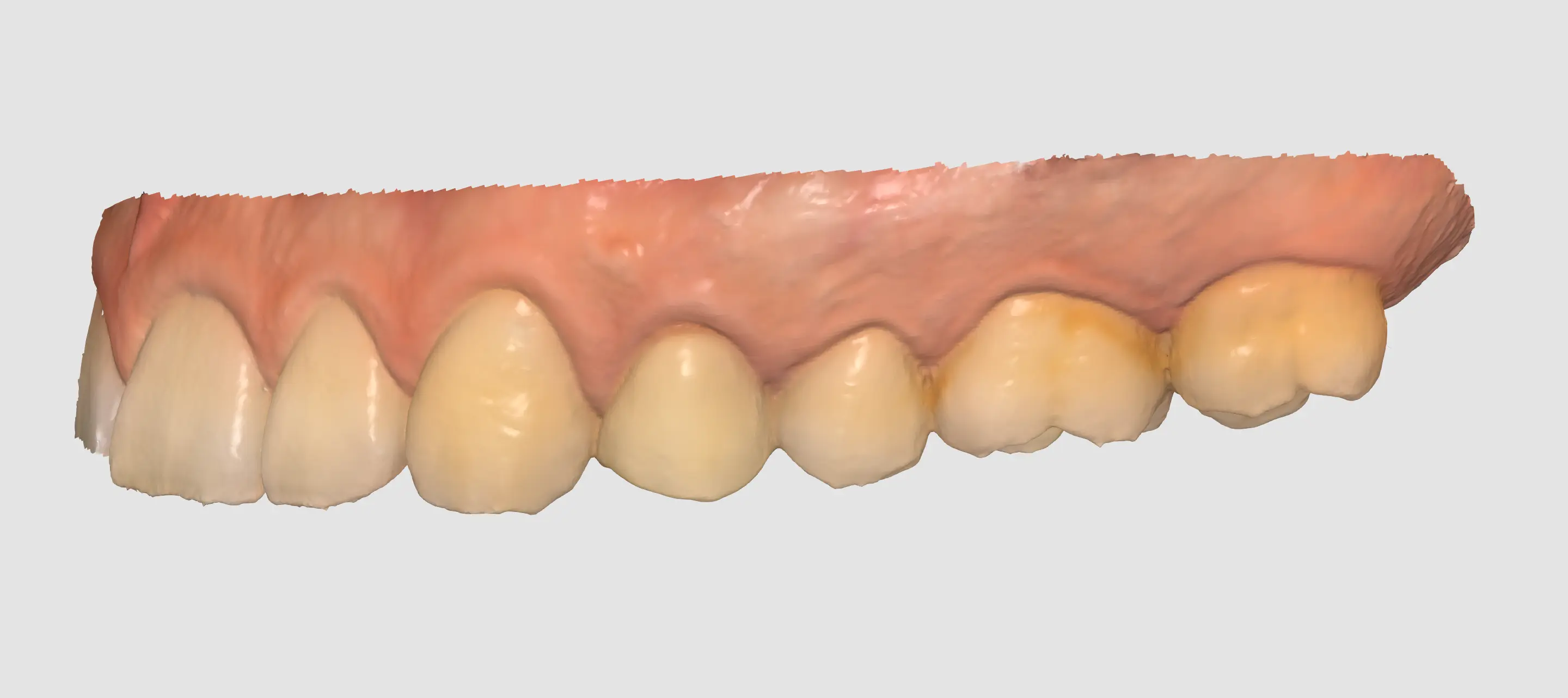 Matte 1.webp