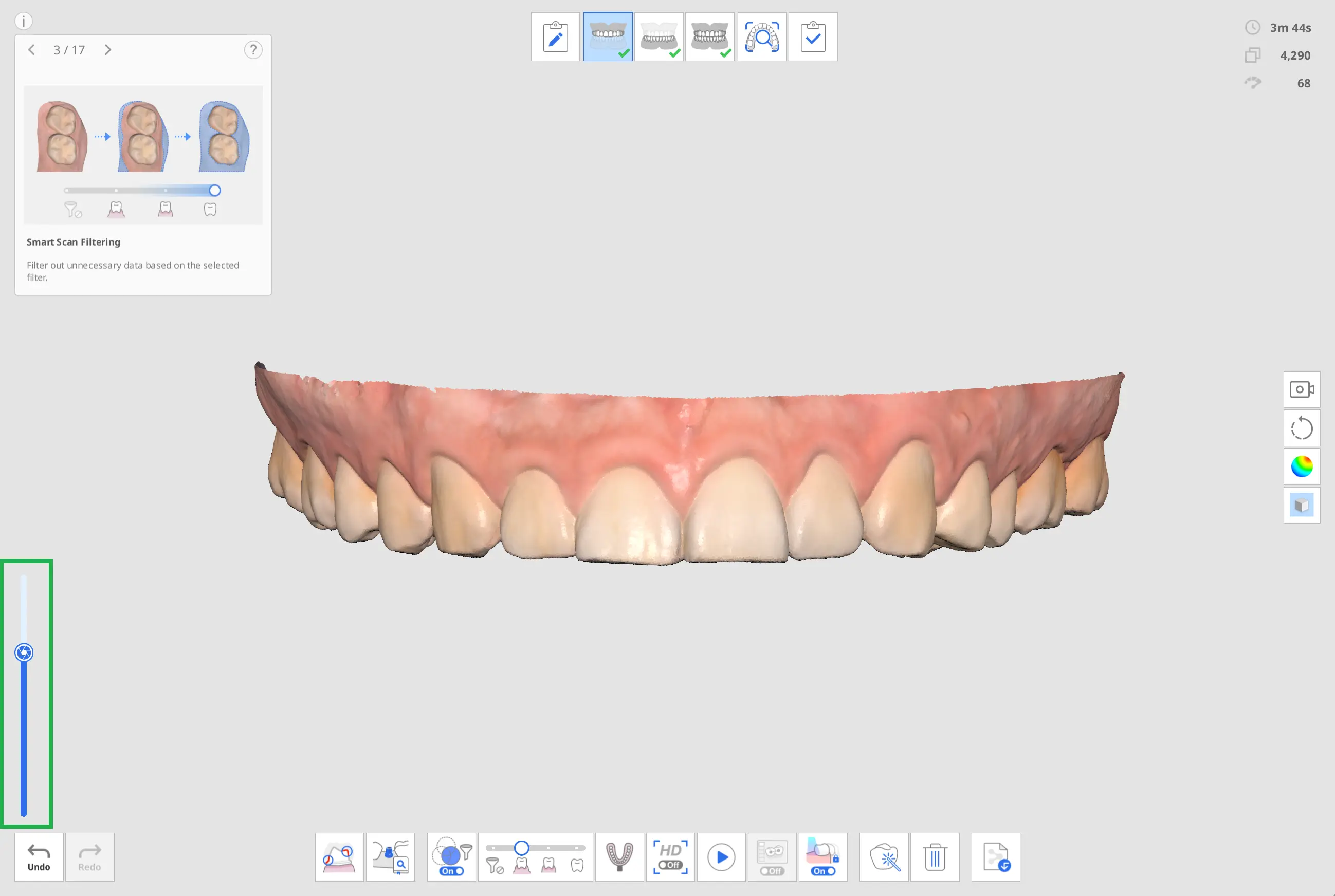 scan depth.webp