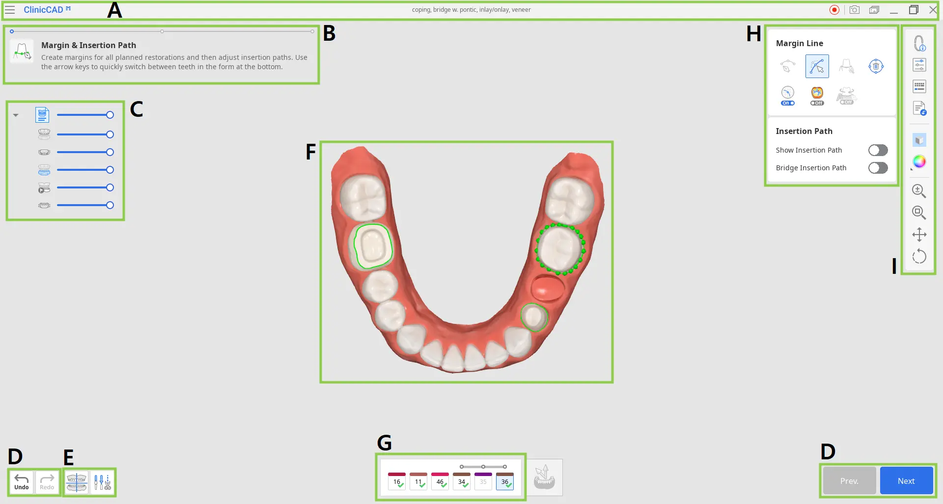 User Interface at a Glance ClinicCAD.webp