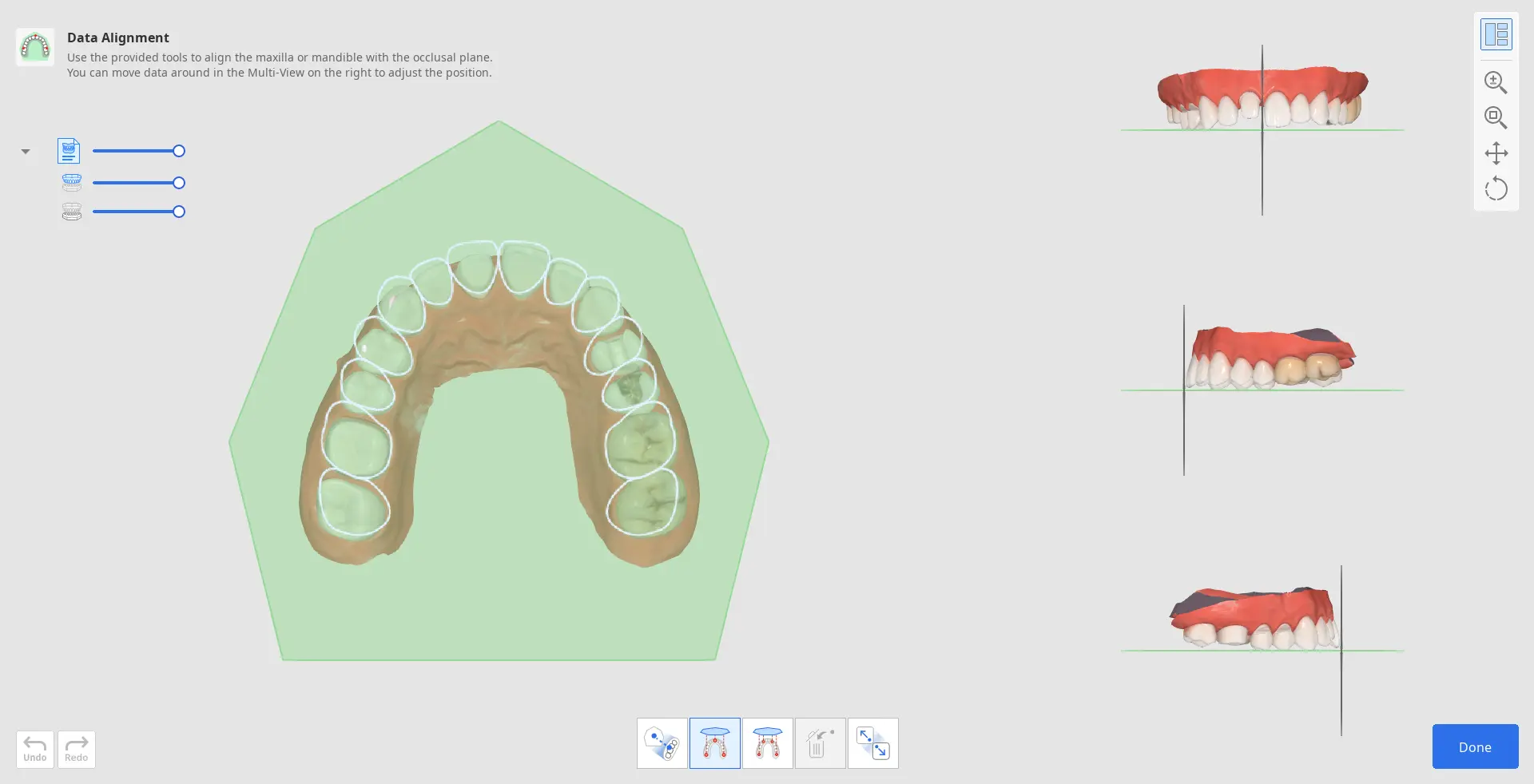 Data Alignment.webp