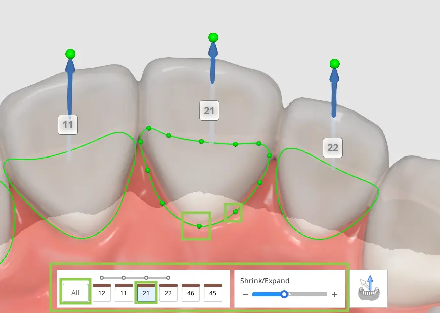 Margin & Insertion Path 1 1.webp