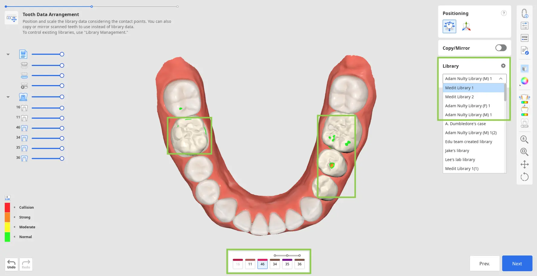 Tooth Data Arrangement 1.webp