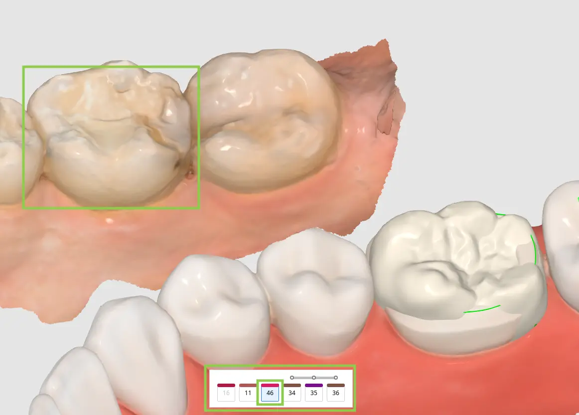 Tooth Data Arrangement 2 1.webp