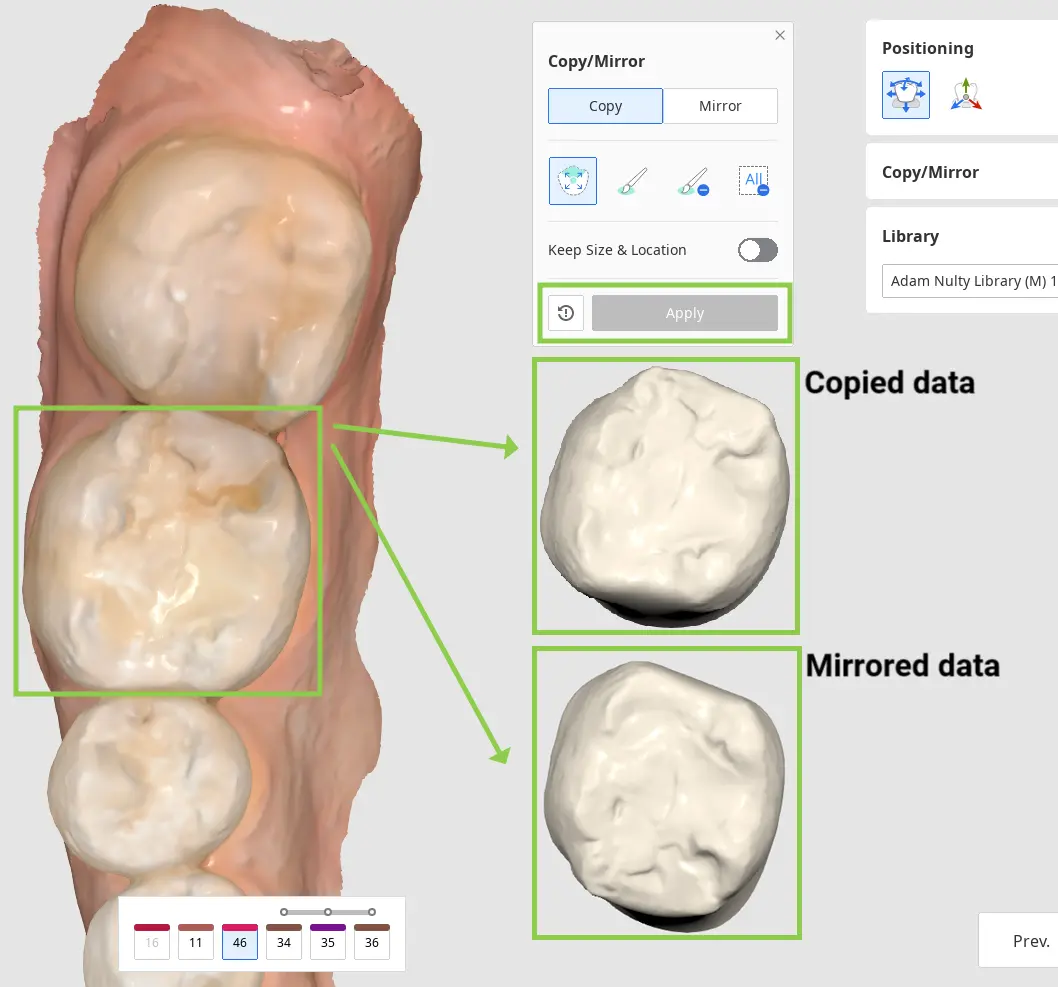Tooth Data Arrangement 2 3.webp
