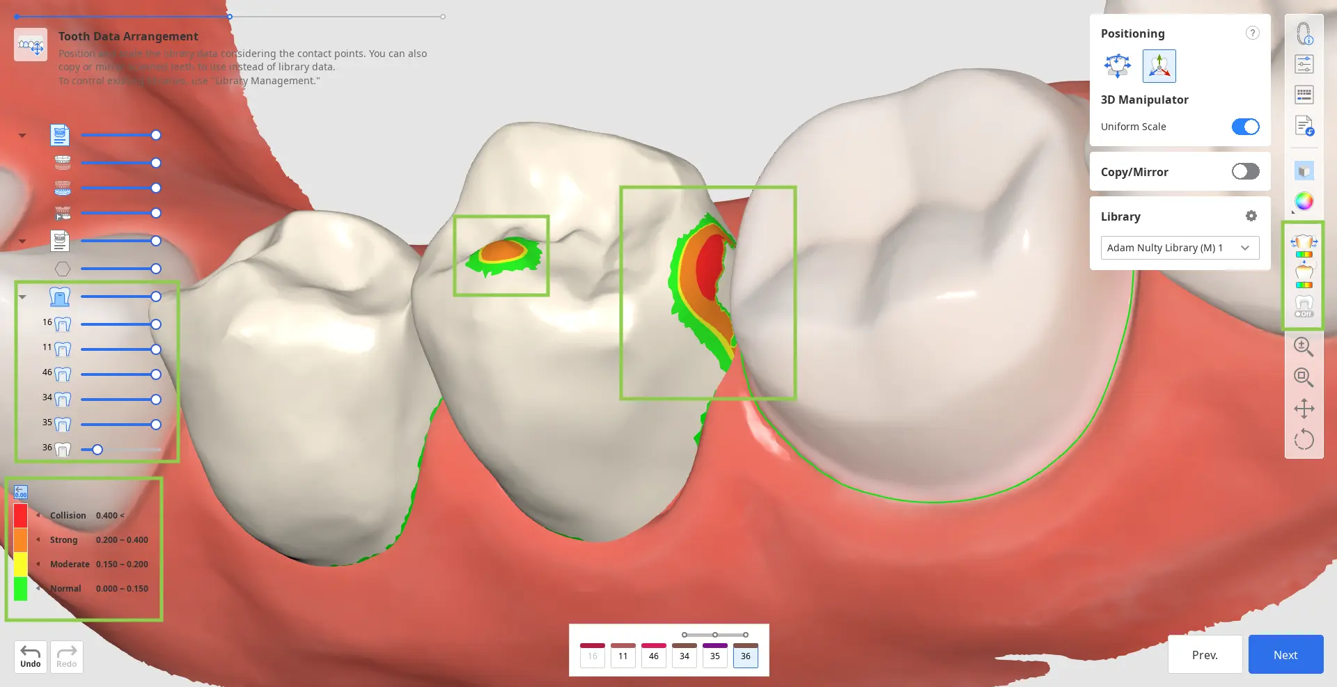 Tooth Data Arrangement 4.webp