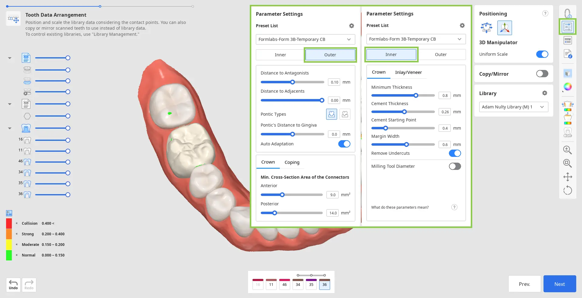 Tooth Data Arrangement 5.webp