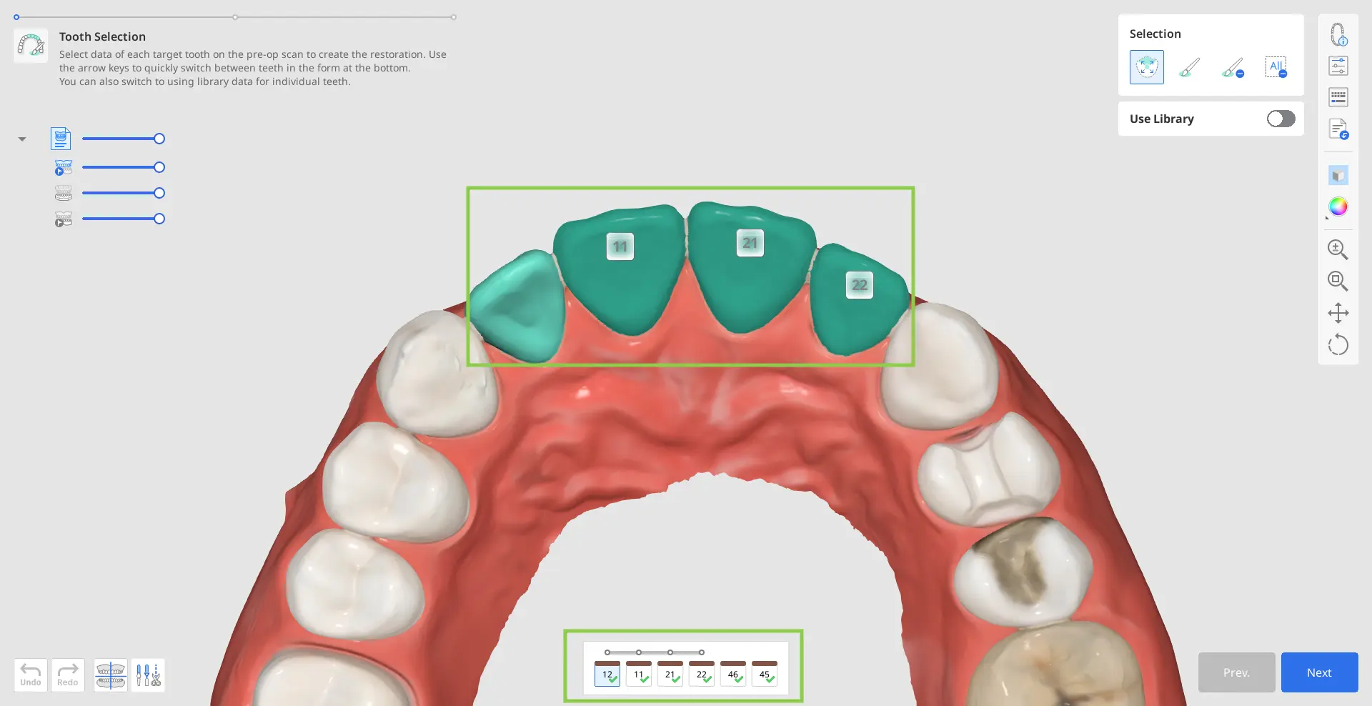 Tooth Selection 1.webp