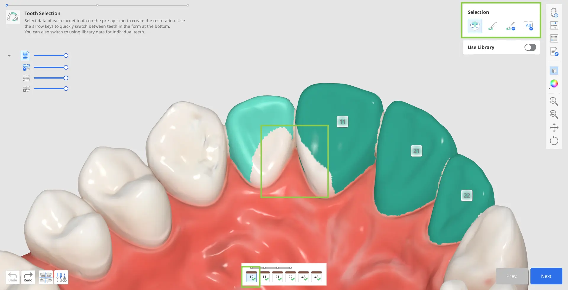 Tooth Selection 2.webp