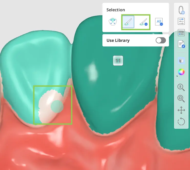 Tooth Selection 2 2.webp