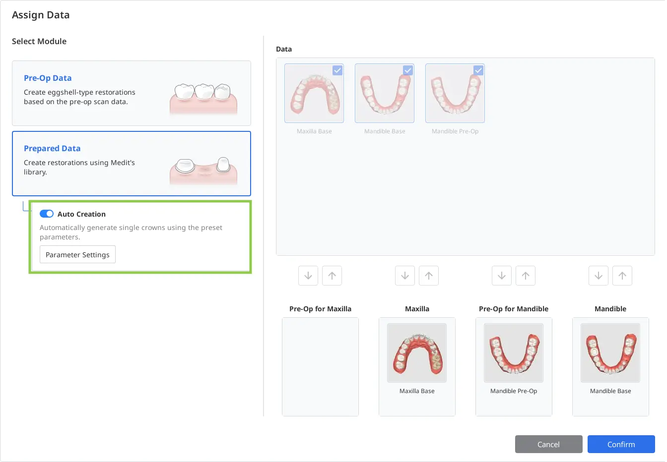 Auto Creation for Single Crowns.webp