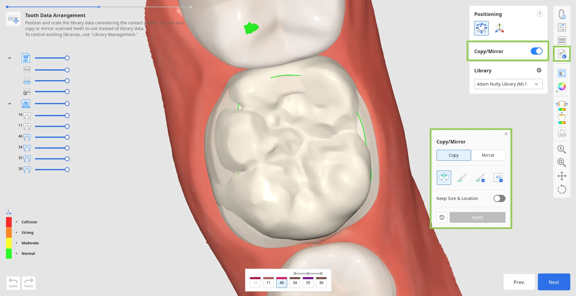 Tooth Data Arrangement 2.webp