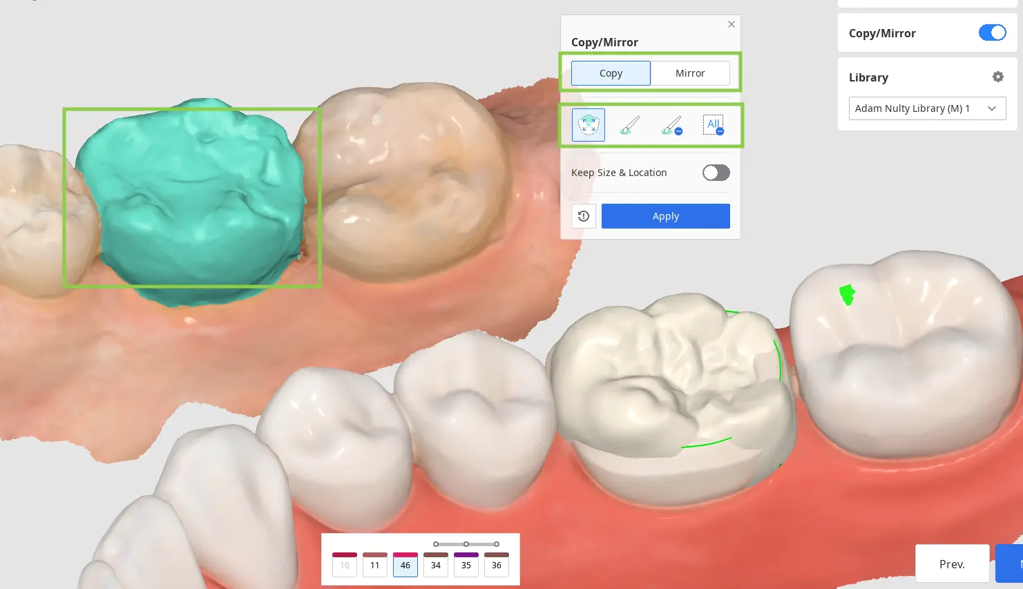 Tooth Data Arrangement 2 2.webp