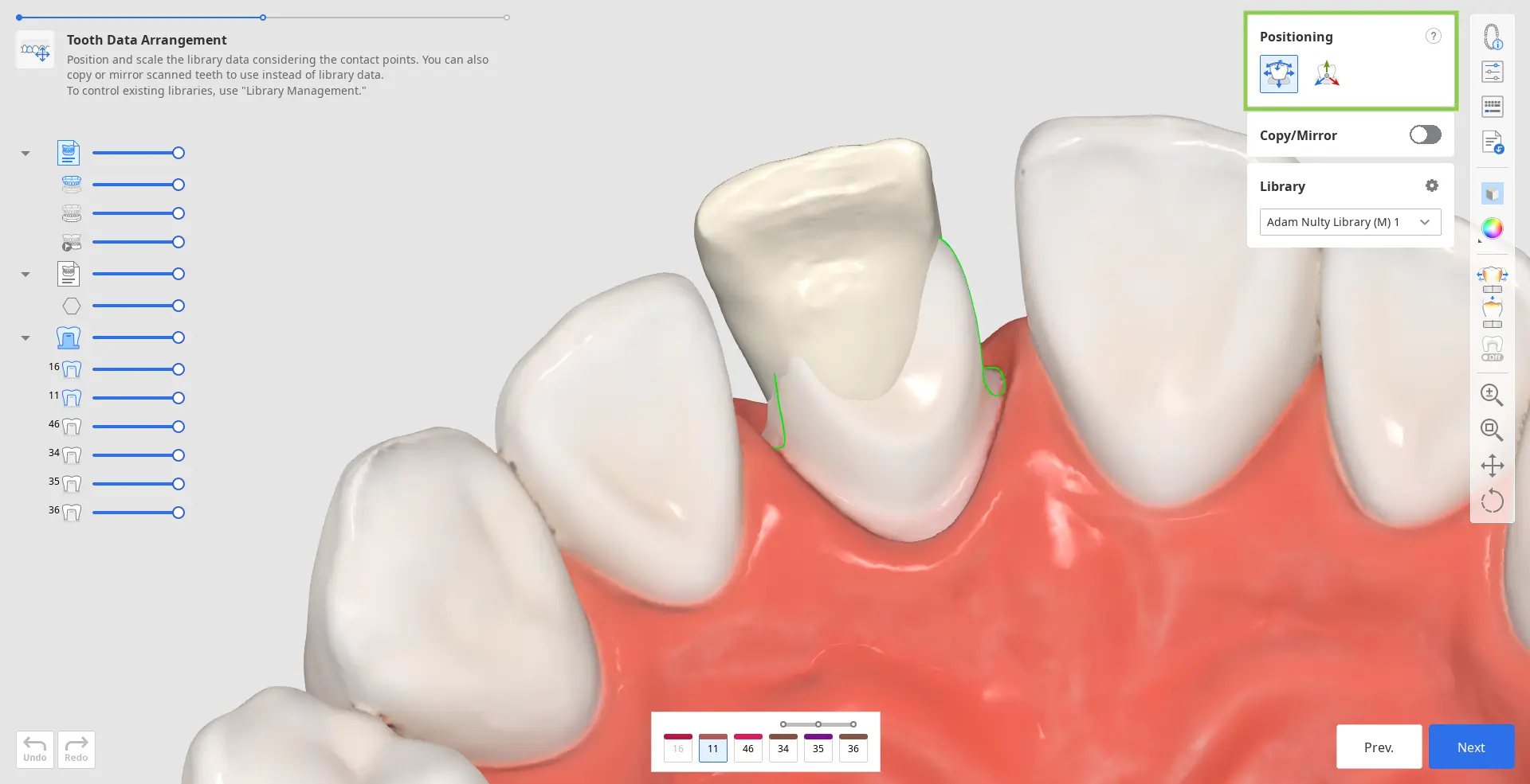 Tooth Data Arrangement 3.webp