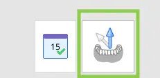 Designing Cervical Inlay 4 1.webp