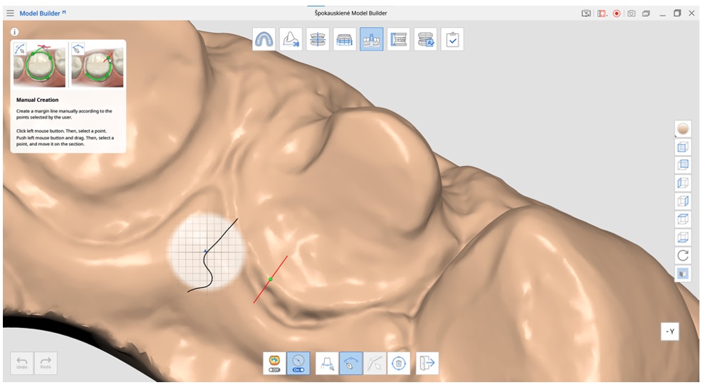 Create a Margin Line in Medit Model Builder.jpg