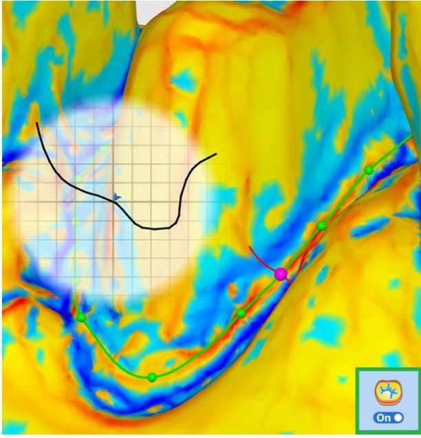 View Curvature 1.jpg