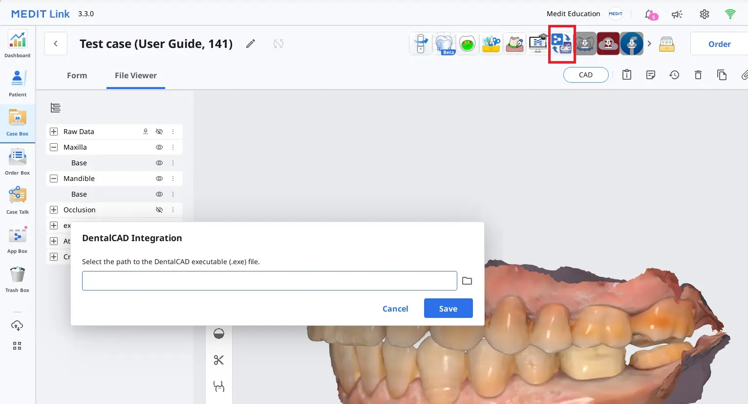 exocad 2 (1).webp