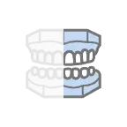 Left Lateral View.webp