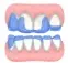 Superimposition.webp