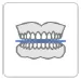 Occlusal Table.webp