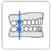 Bite Classification.webp