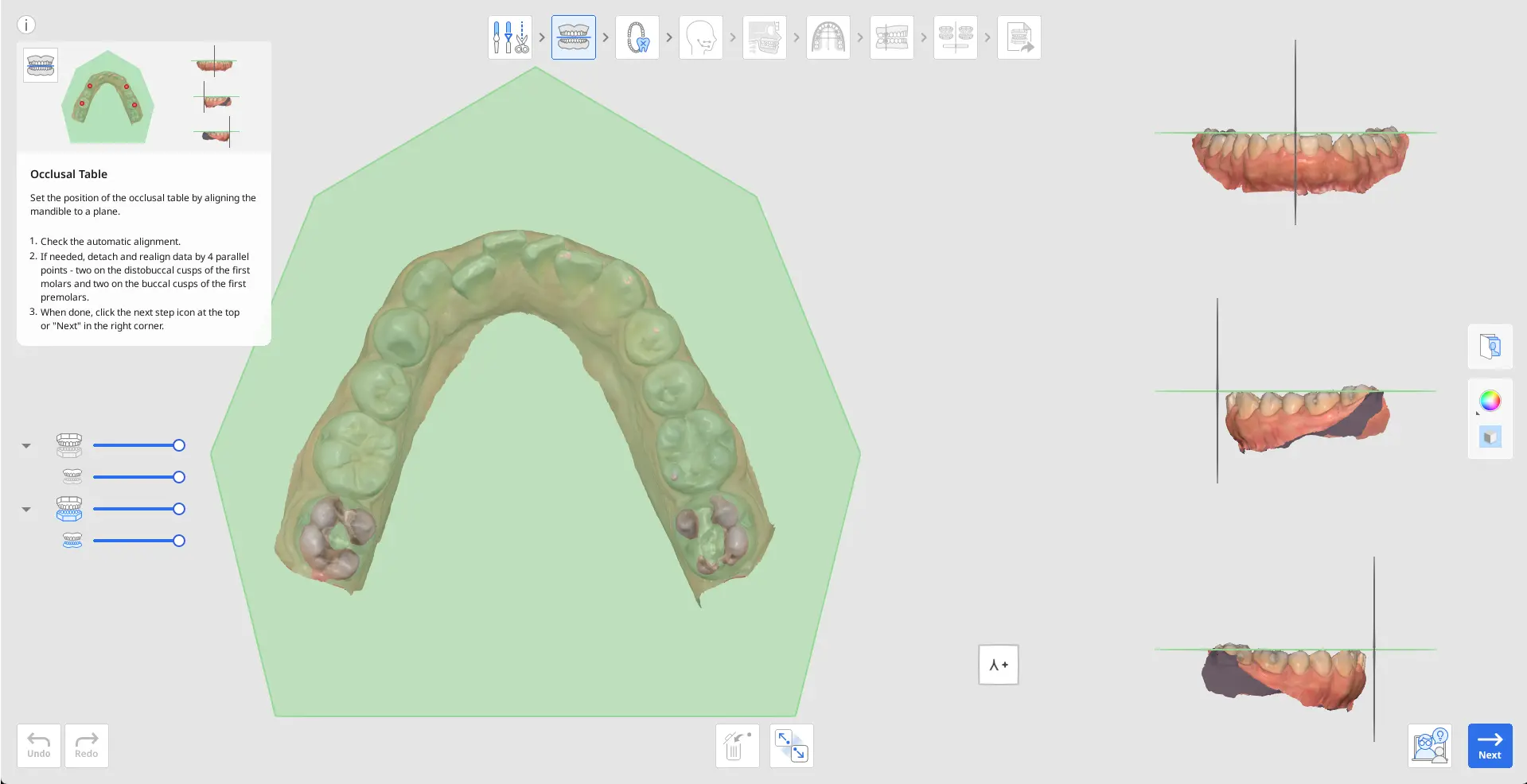 MOS Occlusal Table.webp