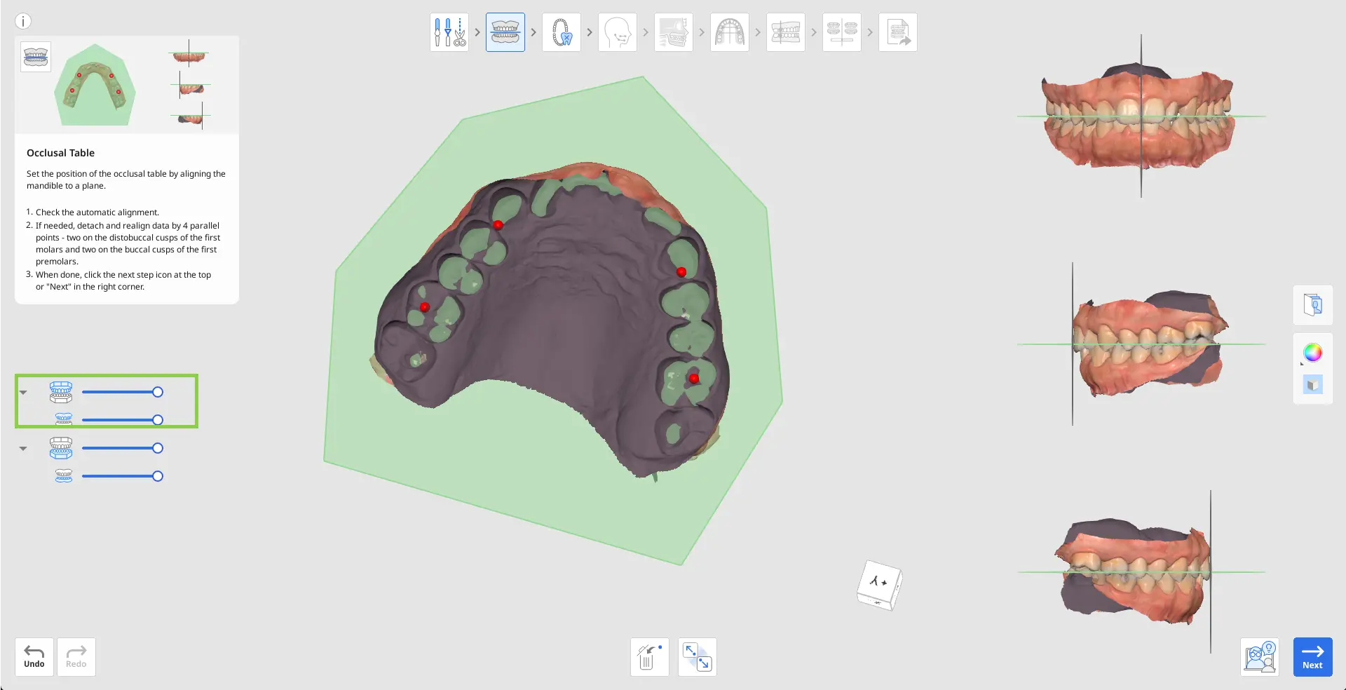 MOS Occlusal Table 2.webp