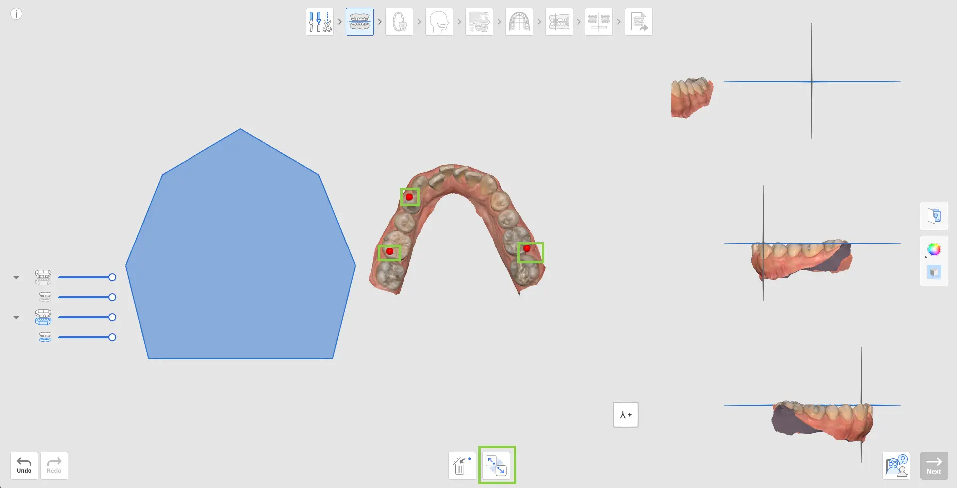 MOS Occlusal Table 3.webp