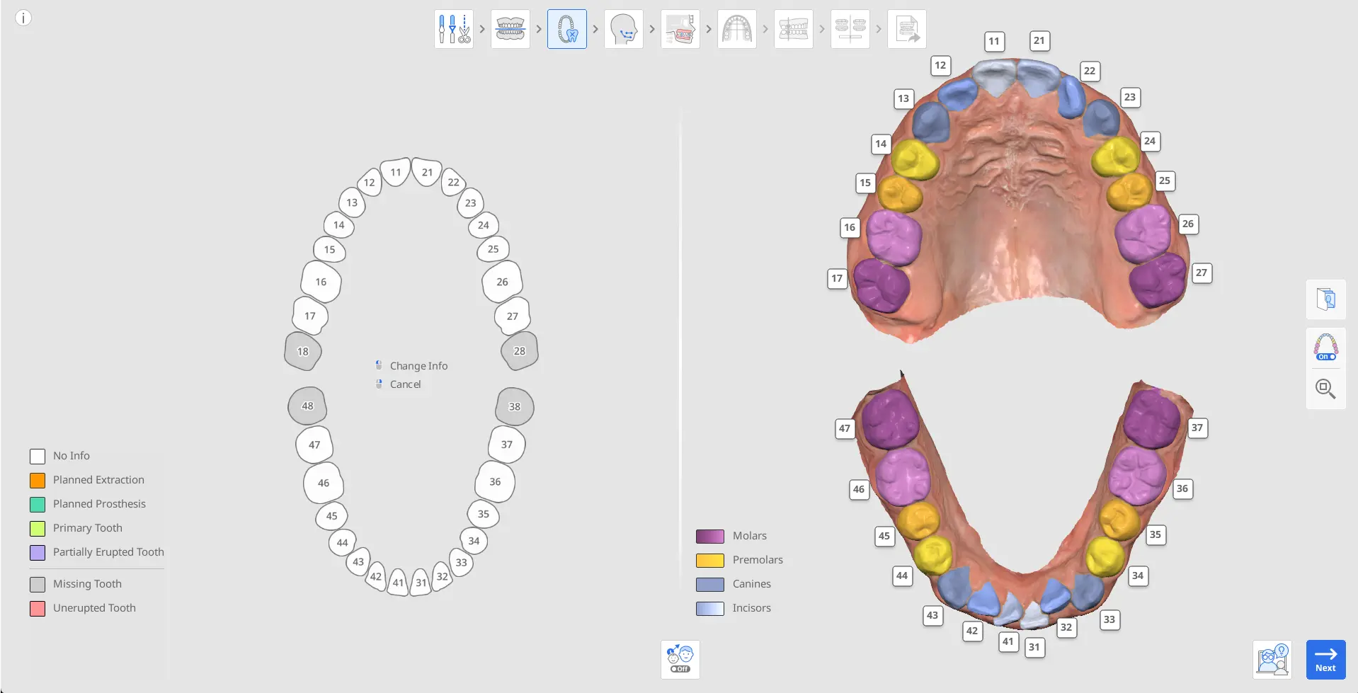 MOS Tooth Identification.webp
