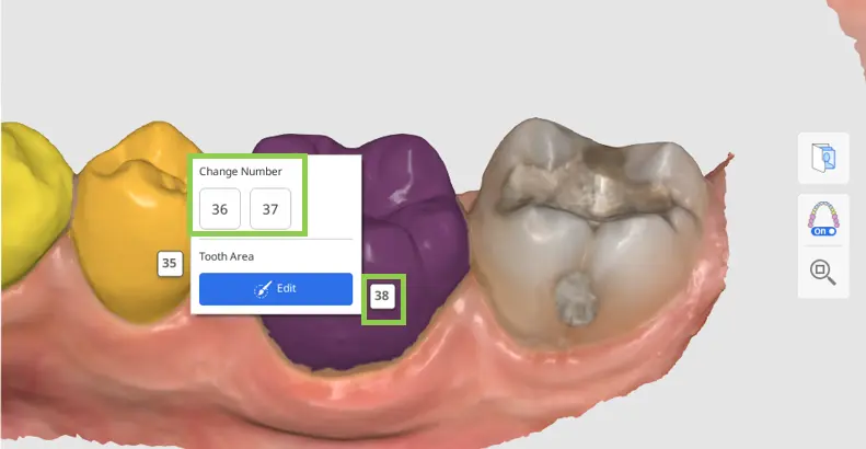 MOS Tooth Identification 1-1.webp