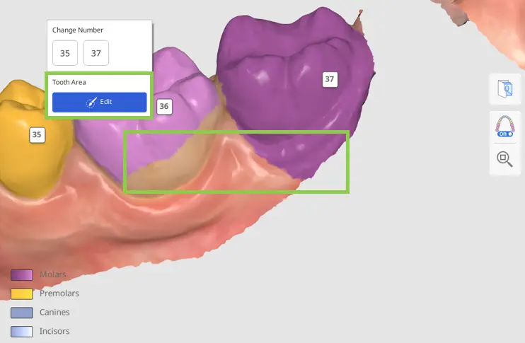 MOS Tooth Identification 1-3.webp