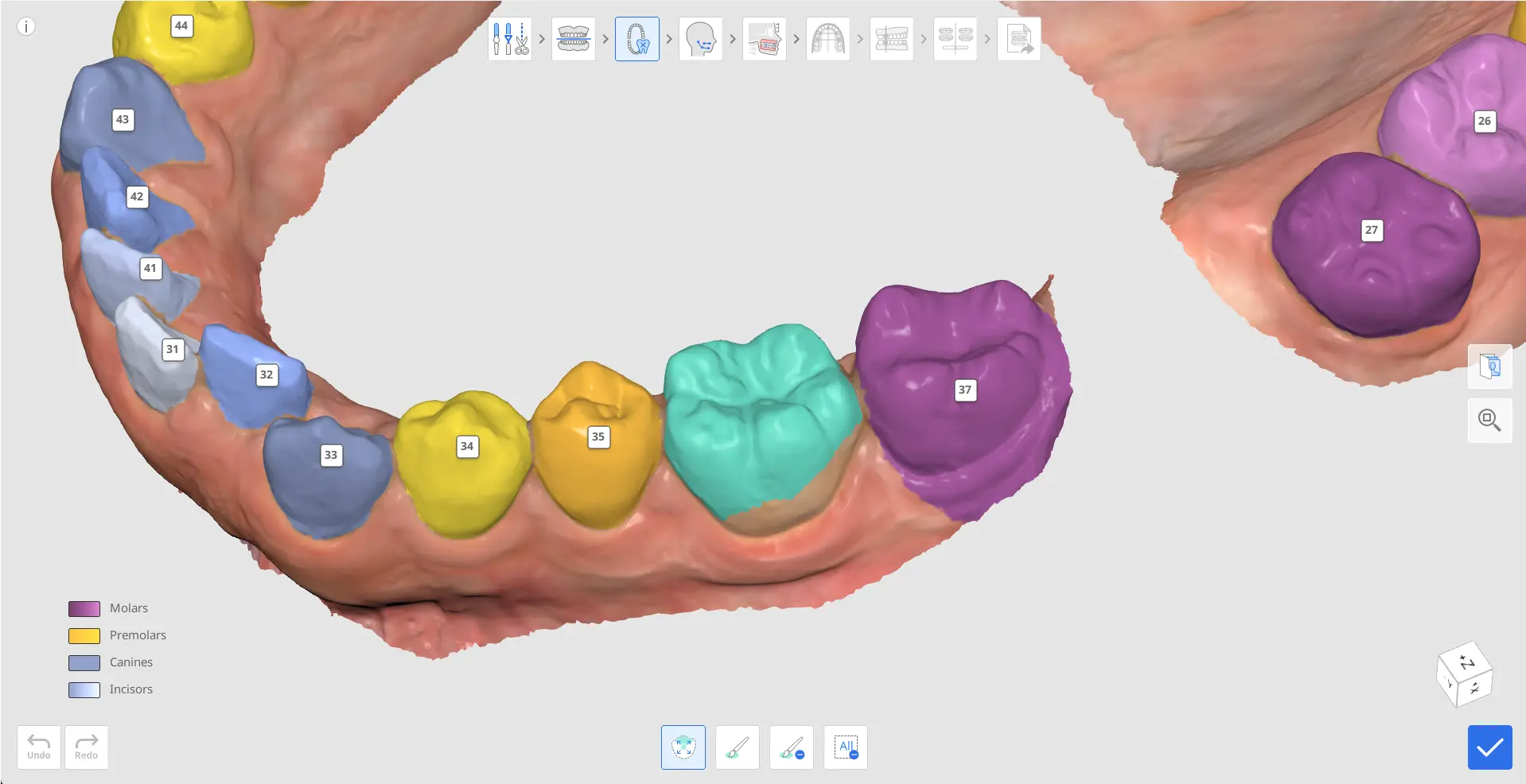 MOS How to Select Tooth Data.webp