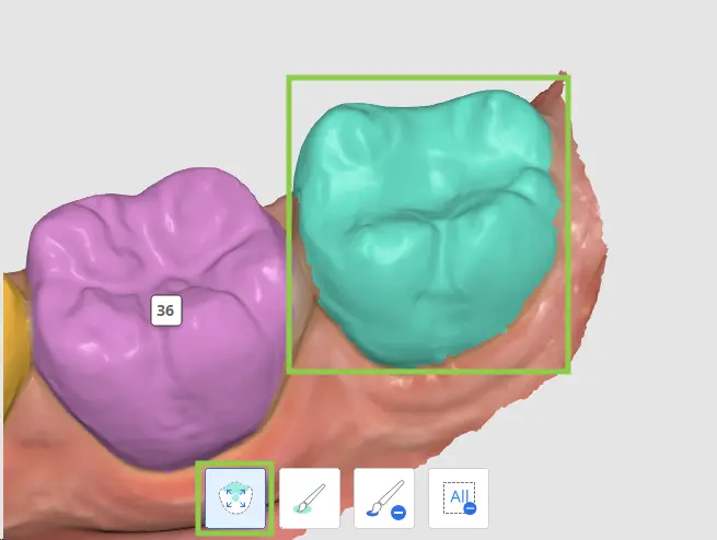 MOS How to Select Tooth Data 1.webp