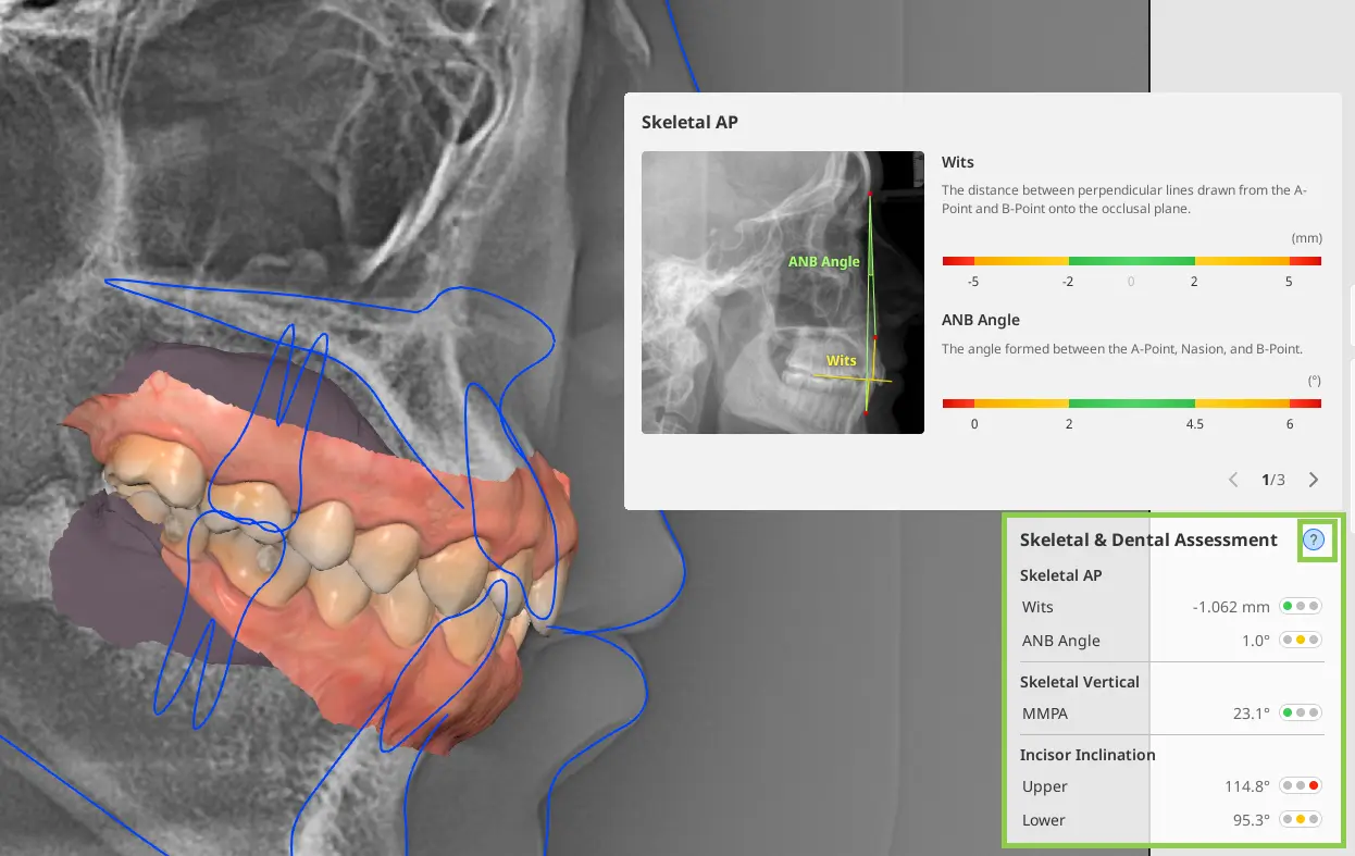 MOS Ceph Overlay 3.webp