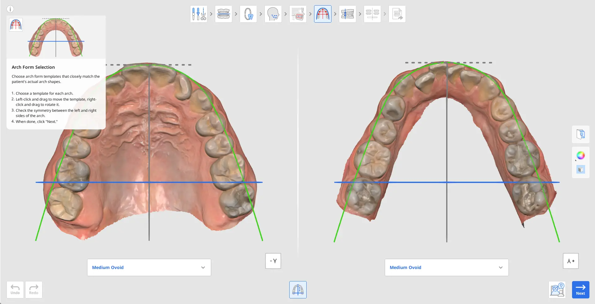 Arch Form Selection (2).webp