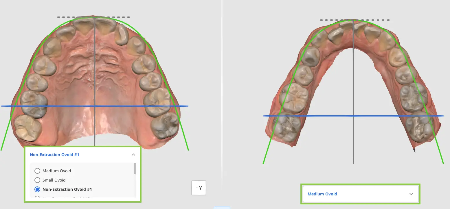 MOS Arch Form Selection 1.webp