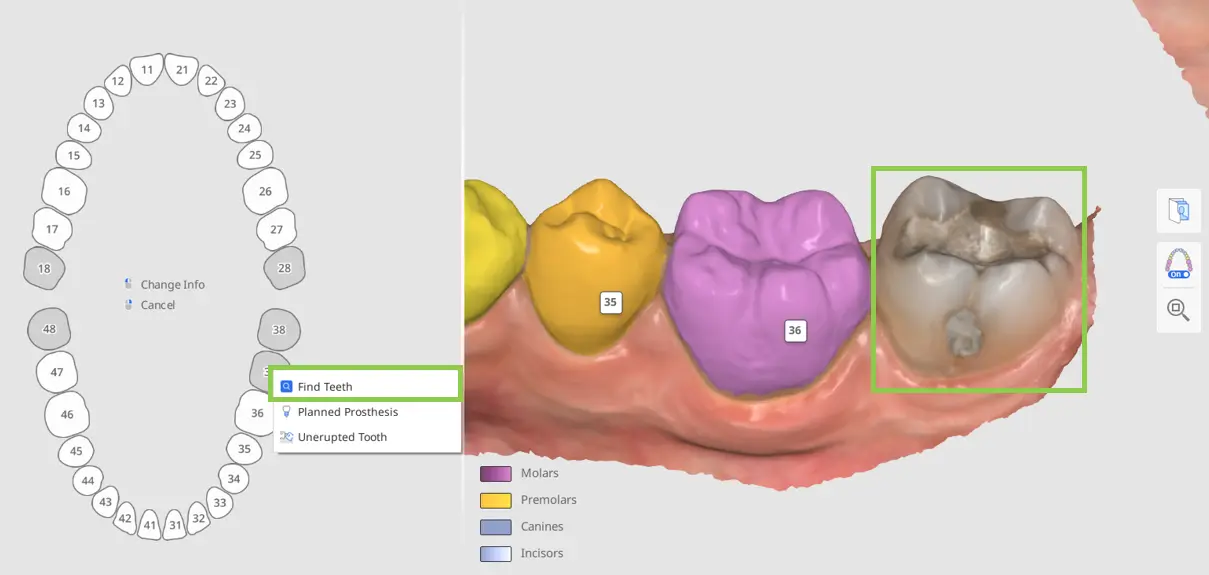 MOS Tooth Identification 1-2.webp