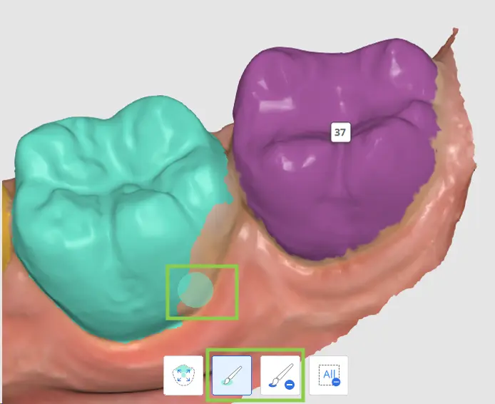 MOS How to Select Tooth Data 2.webp