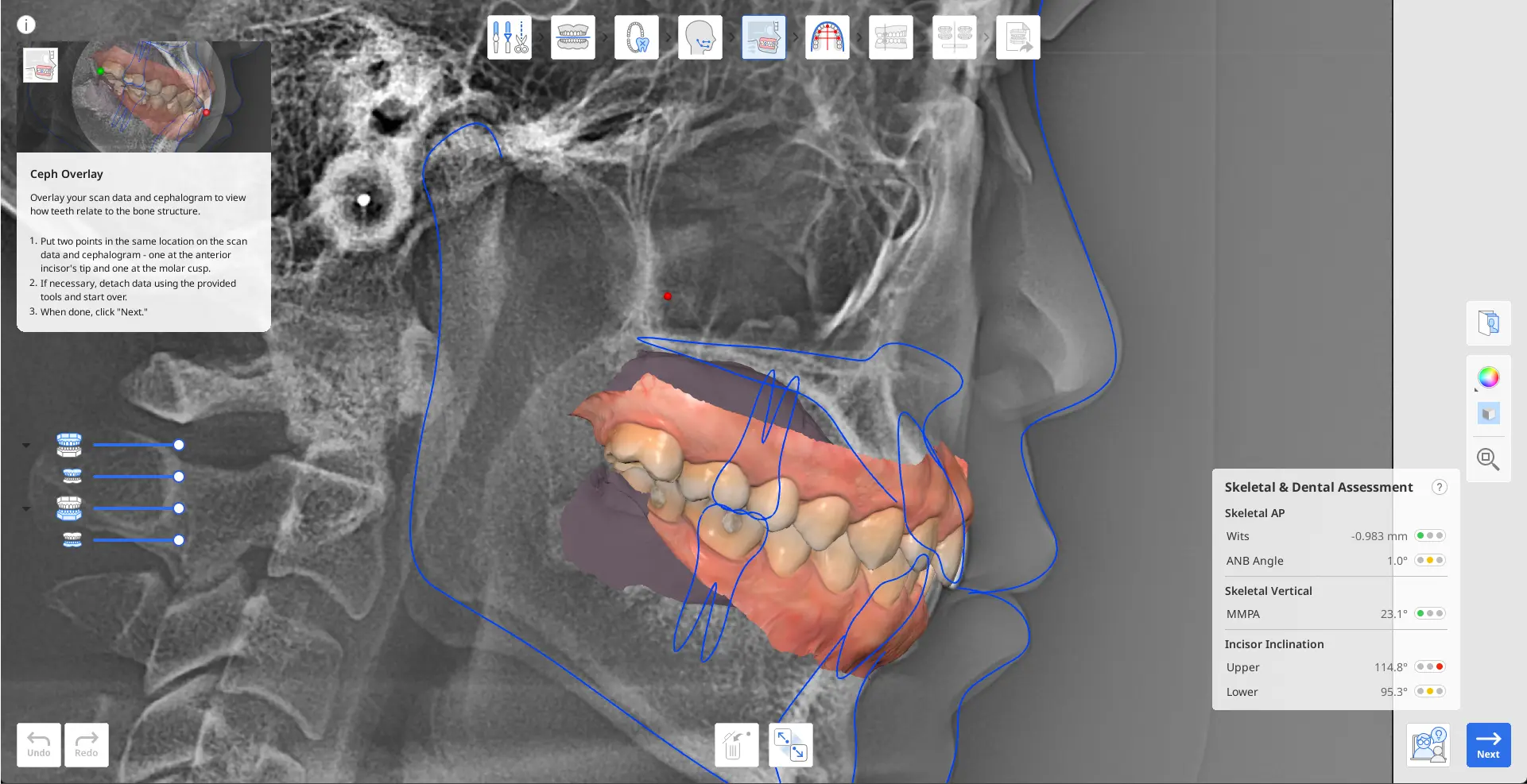 MOS Ceph Overlay.webp