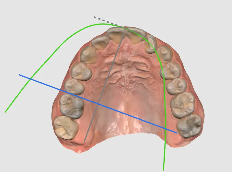 MOS Arch Form Selection 2.webp