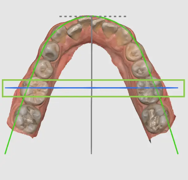 MOS Arch Form Selection 3.webp