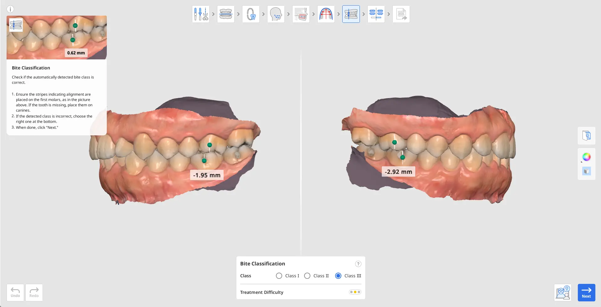 MOS Bite Classification.webp