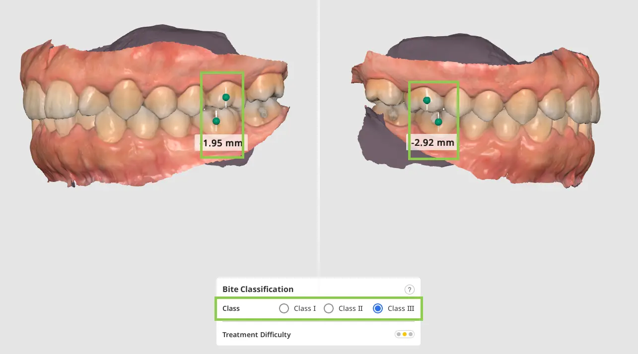 MOS Bite Classification 1.webp