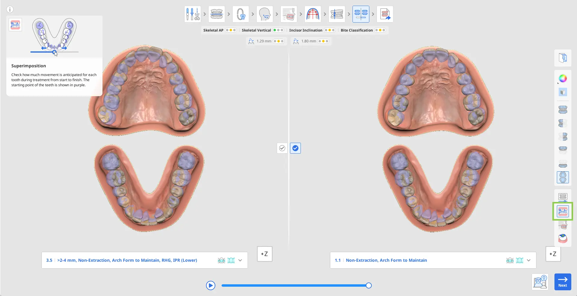 MOS Simulations Preview 3 2.webp