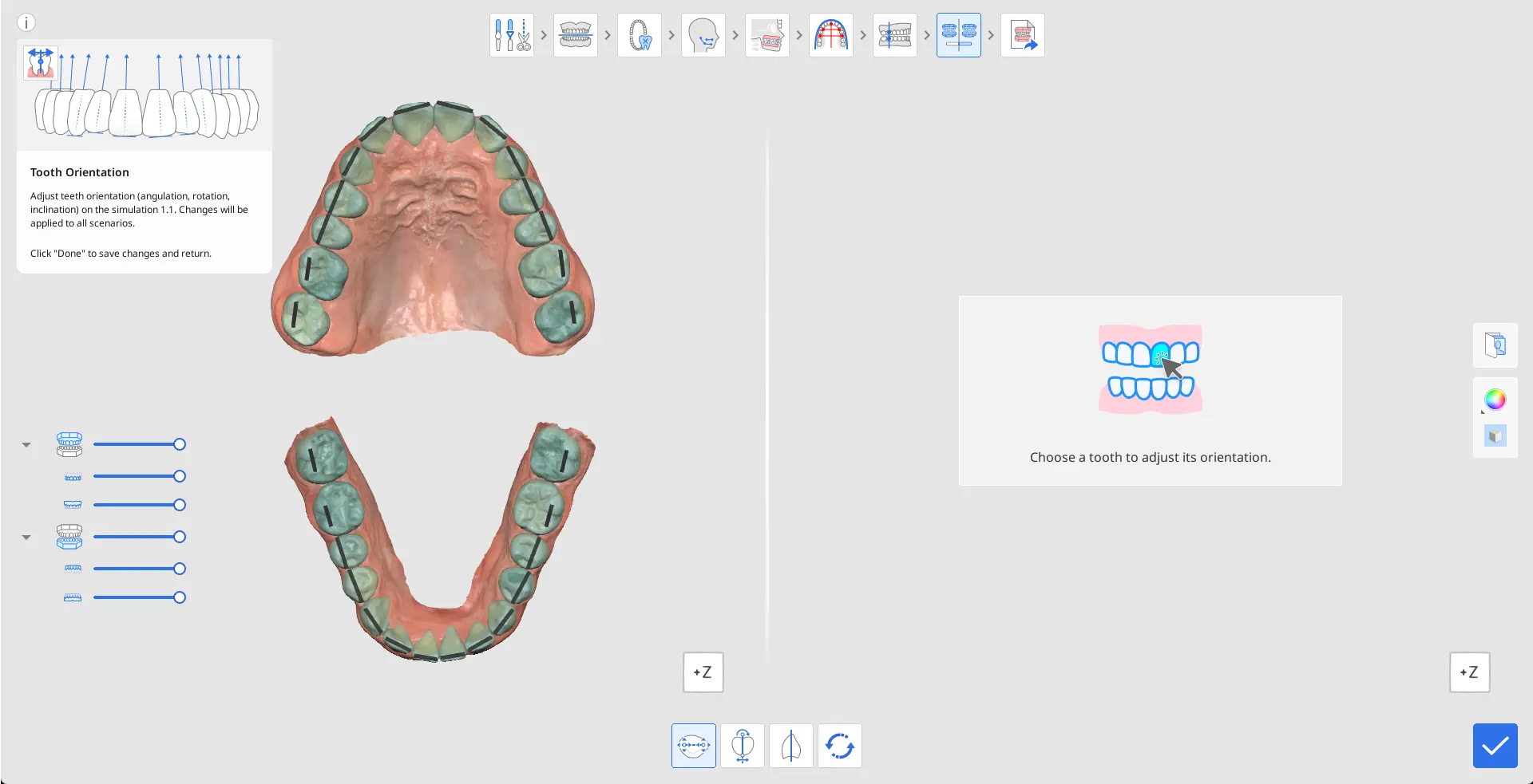 MOS How to Use Tooth Orientation.webp